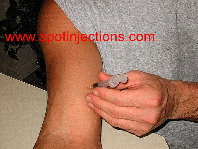 Original watermarked penetration reference for Bicep Series 3