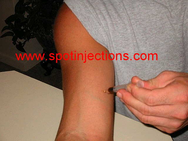 Original watermarked aspiration reference for Bicep Series 3