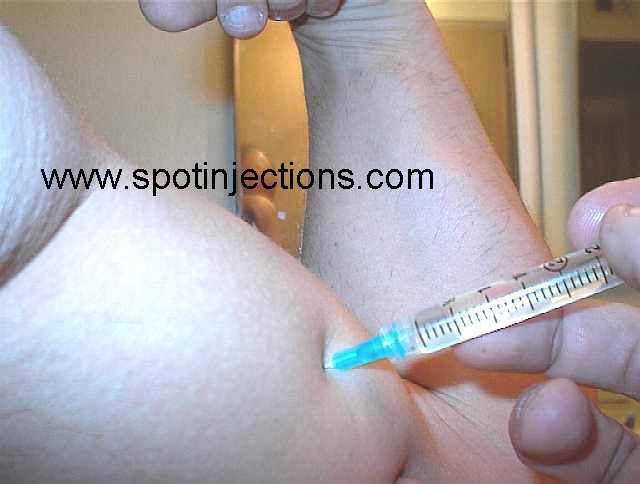 Original watermarked aspiration reference for Bicep Series 2