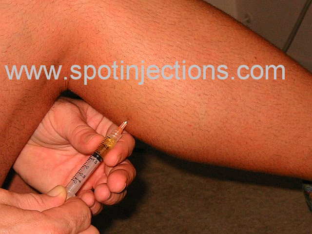 Original watermarked aspiration reference for Calf Series 2