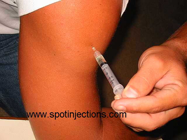 Original watermarked aspiration reference for Delt Series 2
