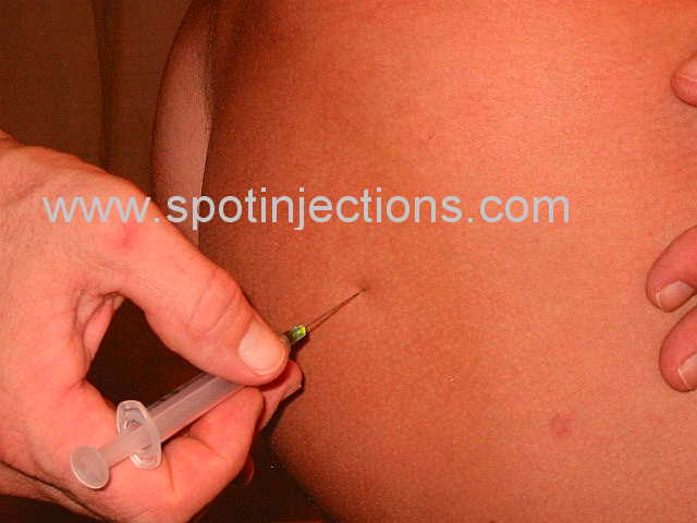 Original watermarked penetration reference for Glute Series 1