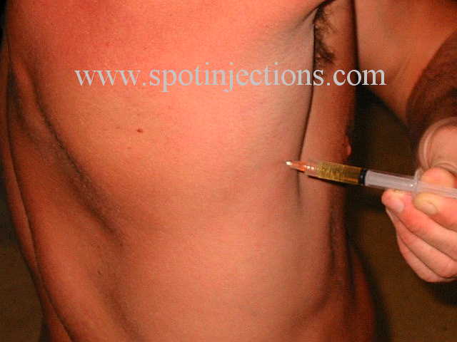 Original watermarked aspiration reference for Lat Series 3