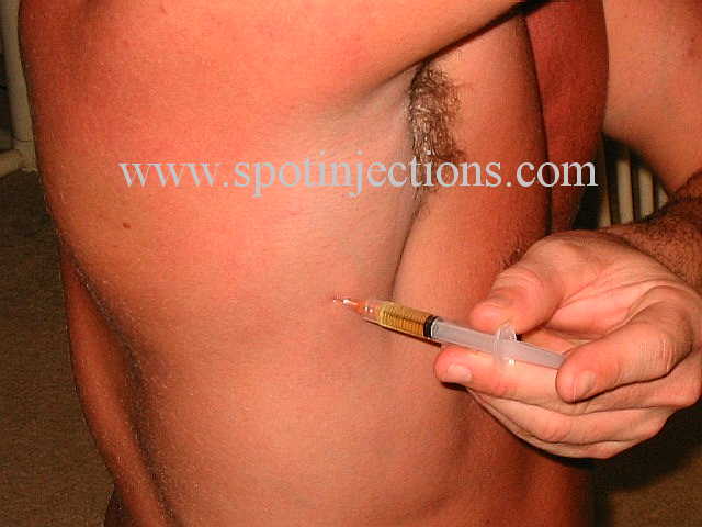 Original watermarked injection reference for Lat Series 3