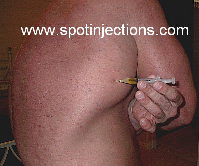 Original watermarked penetration reference for Lat Series 1