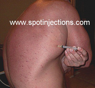 Original watermarked injection reference for Lat Series 1