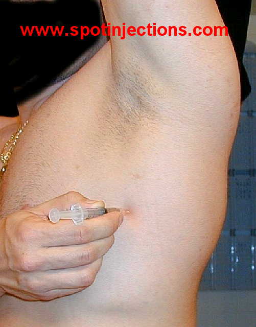 Original watermarked penetration reference for Lat Series 2