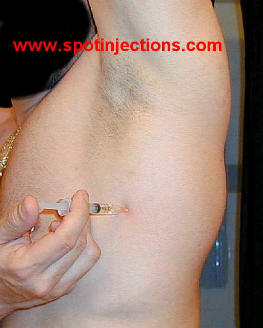 Original watermarked injection reference for Lat Series 2
