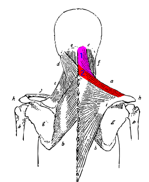 Original muscle map highlighting the Trapezius region