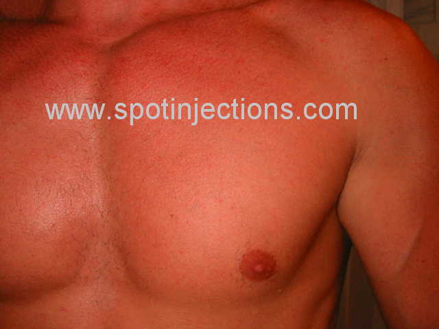 Original watermarked preinjection reference for Pec Series 3