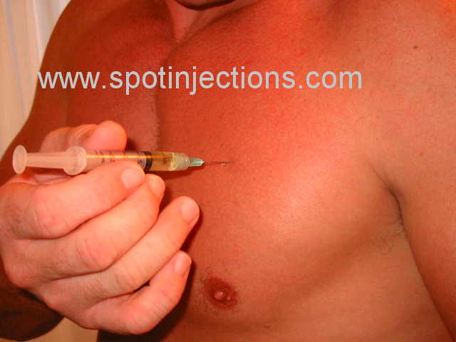 Original watermarked penetration reference for Pec Series 3