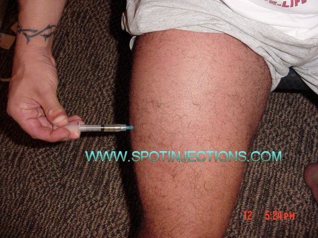 Original watermarked aspiration reference for Thigh Series 3