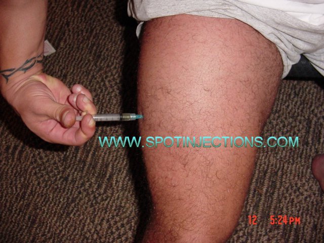 Original watermarked injection reference for Thigh Series 3