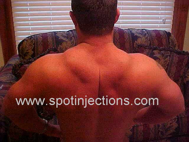 Original watermarked preinjection reference for Trap Series 1