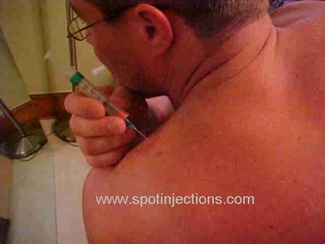 Original watermarked penetration reference for Trap Series 1