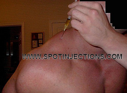 Original watermarked preinjection reference for Trap Series 2