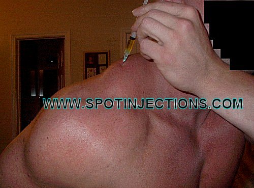 Original watermarked penetration reference for Trap Series 2