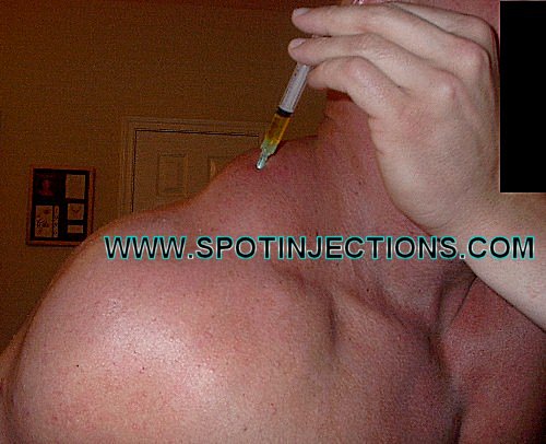 Original watermarked aspiration reference for Trap Series 2