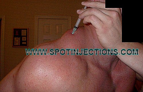 Original watermarked injection reference for Trap Series 2