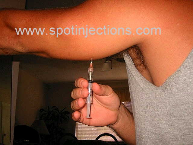 Original watermarked penetration reference for Tricep Series 3