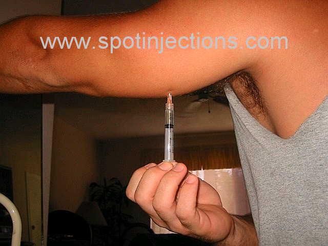 Original watermarked aspiration reference for Tricep Series 3