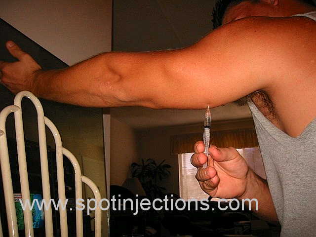 Original watermarked injection reference for Tricep Series 3